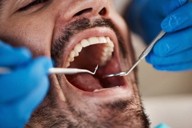 Emergency Dental Services in Summit Hill, PA